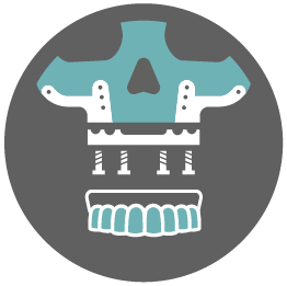 Icon for CUSTOMIZED IMPLANTS