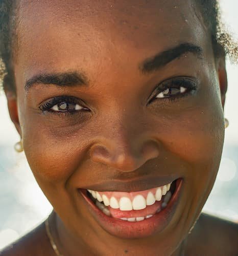 Image of FULL MOUTH VENEERS